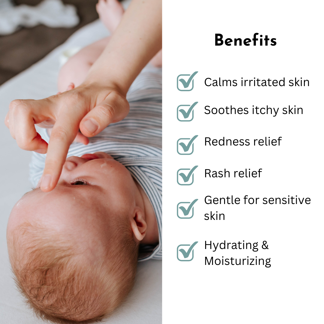 Baby Eczema Relief Balm