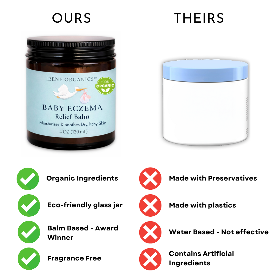 Baby Eczema Relief Balm